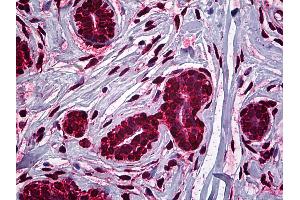 Anti-MDM2 antibody IHC of human breast. (MDM2 antibody  (AA 101-201))