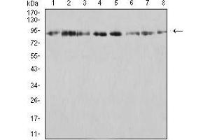 Western blot analysis using KDM1A mouse mAb against SK-Br-3 (1), K562 (2), SW480 (3), Jurkat (4), Hela (5), COS7 (6), T47D (7), and HCT116 (8) cell lysate. (LSD1 antibody  (AA 55-263))