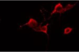ABIN6277989 staining A549 cells by IF/ICC. (Amyloid beta (A4) Precursor Protein-Binding, Family B, Member 1 Interacting Protein (APBB1IP) (Internal Region) antibody)