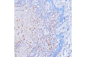 Immunohistochemistry of paraffin-embedded human esophageal using NME6 antibody (ABIN7268942) at dilution of 1:100 (40x lens). (NME6 antibody  (AA 9-194))