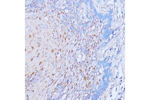 Immunohistochemistry of paraffin-embedded human esophageal using NME6 antibody (ABIN7268942) at dilution of 1:100 (40x lens).