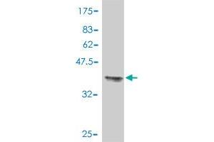 Western Blot detection against Immunogen (37. (TUBB2A antibody  (AA 1-100))