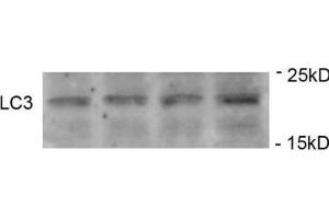 Western Blotting (WB) image for anti-Microtubule-Associated Protein 1 Light Chain 3 gamma (MAP1LC3C) (pSer12) antibody (ABIN2970987) (LC3C antibody  (pSer12))