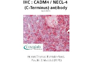 Image no. 1 for anti-Cell Adhesion Molecule 4 (CADM4) antibody (ABIN1732542) (Cell Adhesion Molecule 4 antibody)