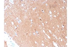 Formalin-fixed, paraffin-embedded human Brain stained with Tubulin beta 3 Mouse Monoclonal Antibody (TUBB3/3731). (TUBB3 antibody  (AA 437-450))
