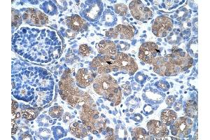 ASS1 antibody was used for immunohistochemistry at a concentration of 4-8 ug/ml to stain Epithelial cells of renal tubule (arrows) in Human Kidney. (ASS1 antibody  (C-Term))
