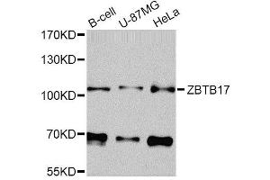 Western blot analysis of extracts of various cell lines, using ZBTB17 Antibody (ABIN5974597) at 1/1000 dilution. (ZBTB17 antibody)