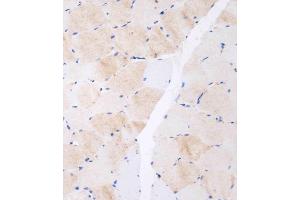 Immunohistochemistry (Paraffin-embedded Sections) (IHC (p)) image for anti-C-Type Lectin Domain Family 4, Member F (CLEC4F) (AA 311-339), (C-Term) antibody (ABIN655236)