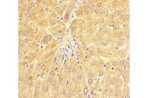 Immunohistochemistry of paraffin-embedded human liver tissue using ABIN7147720 at dilution of 1:100 (CHD4 antibody  (AA 1-219))
