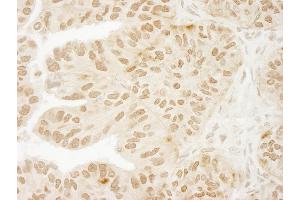 Immunohistochemistry (IHC) image for anti-Ubiquitin Specific Peptidase 15 (USP15) (C-Term) antibody (ABIN7448852) (USP15 antibody  (C-Term))
