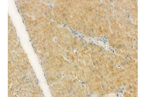 ABIN7093849 and ABIN7097892 at 1/100 staining human normal gastric tissue by IHC-P.