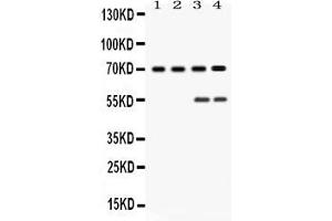 Western blot analysis of YAP1 expression in rat testis extract ( Lane 1), mouse ovary extract ( Lane 2), HELA whole cell lysates ( Lane 3) and MCF-7 whole cell lysates ( Lane 4). (YAP1 antibody  (N-Term))