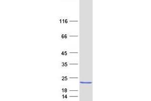 Validation with Western Blot
