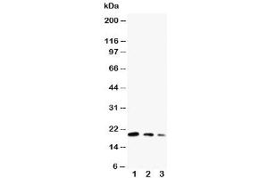 Western blot testing of CDC42 antibody and Lane 1:  ecombinant human protein 10ng