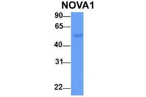 Host:  Rabbit  Target Name:  NOVA1  Sample Type:  Human Adult Placenta  Antibody Dilution:  1. (NOVA1 antibody  (C-Term))