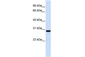 RPA4 antibody used at 1 ug/ml to detect target protein. (RPA4 antibody  (C-Term))