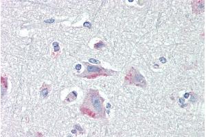 ABIN190893 (5µg/ml) staining of paraffin embedded Human Cortex. (CRHR1 antibody  (AA 250-263))