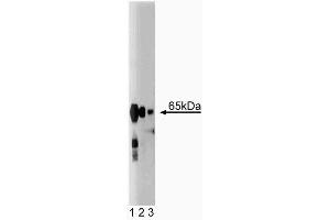 Western blot analysis of Synaptotagmin on rat brain lysate. (Synaptotagmin antibody  (AA 72-223))