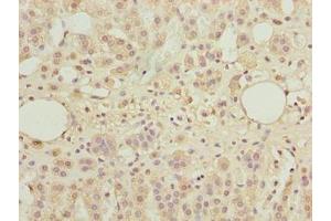 Immunohistochemistry of paraffin-embedded human adrenal gland tissue using ABIN7171598 at dilution of 1:100 (TBC1D14 antibody  (AA 136-435))