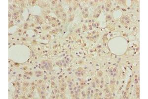 Immunohistochemistry of paraffin-embedded human adrenal gland tissue using ABIN7171598 at dilution of 1:100 (TBC1D14 antibody  (AA 136-435))