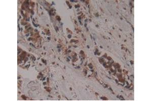 Immunohistochemistry (IHC) image for anti-Growth Differentiation Factor 3 (GDF3) (AA 251-364) antibody (ABIN7427546)