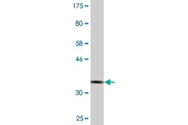 Peripherin antibody  (AA 374-470)