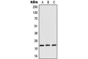 Western blot analysis of RANBP1 expression in HeLa (A), mouse brain (B), rat brain (C) whole cell lysates.