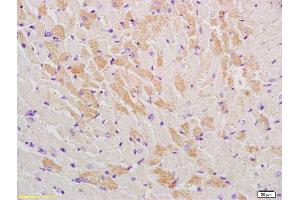 Formalin-fixed and paraffin embedded mouse heart labeled with Rabbit Anti-GLUT12 Polyclonal Antibody, Unconjugated (ABIN741765) at 1:200, followed by conjugation to the secondary antibody and DAB staining
