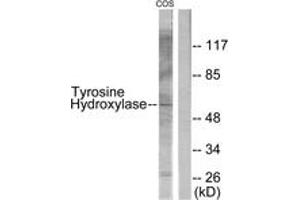 Western blot analysis of extracts from COS7, using Tyrosine Hydroxylase (Ab-31) Antibody. (Tyrosine Hydroxylase antibody  (AA 1-50))