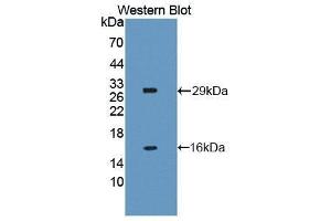 Western Blotting (WB) image for anti-NLR Family, Apoptosis Inhibitory Protein (NAIP) (AA 500-759) antibody (ABIN3206492) (NAIP antibody  (AA 500-759))