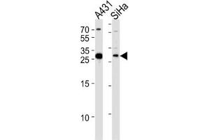 Western Blotting (WB) image for anti-Hydroxysteroid (17-Beta) Dehydrogenase 12 (HSD17B12) antibody (ABIN3004142) (HSD17B12 antibody)