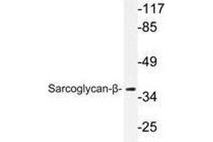 Western blot analysis of Sarcoglycan-β antibody in extracts from A549 cells. (SGCB antibody)