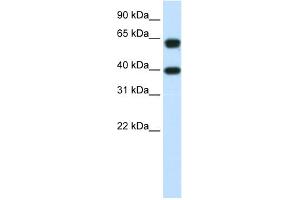 WB Suggested Anti-NXF3 Antibody Titration:  1. (NXF3 antibody  (C-Term))