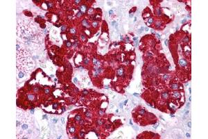 Immunohistochemistry of formalin-fixed, paraffin-embedded human adrenal tissue after heat-induced antigen retrieval. (NR4A2 antibody  (N-Term))