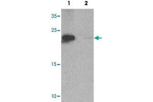 Western blot analysis of NIH/3T3 cell tissue lysate with ZFYVE21 polyclonal antibody  at 1 ug/mL in (1) the absence and (2) the presence of blocking peptide. (ZFYVE21 antibody  (N-Term))