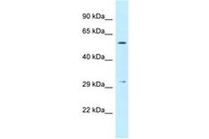 Image no. 1 for anti-Cysteine-Rich Secretory Protein LCCL Domain Containing 1 (CRISPLD1) (AA 206-255) antibody (ABIN6747906) (CRISPLD1 antibody  (AA 206-255))