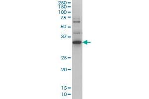 ZIC4 monoclonal antibody (M01), clone 4B1 Western Blot analysis of ZIC4 expression in Hela S3 NE . (ZIC4 antibody  (AA 249-319))