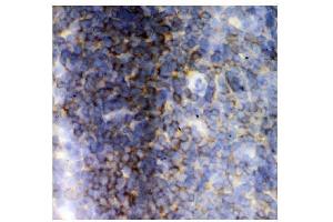 IHC analysis of Lck using anti-Lck antibody (ABIN3043870). (LCK antibody  (C-Term))