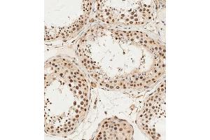 (ABIN1538275 and ABIN2849896) staining ALKBH5 in human testis tissue sections by Immunohistochemistry (IHC-P - paraformaldehyde-fixed, paraffin-embedded sections). (ALKBH5 antibody  (AA 302-330))