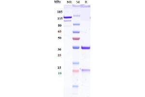 Anti-IGF-2 Reference Antibody (DX-2647) on SDS-PAGE under reducing (R) condition.