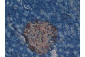 Immunohistochemistry (IHC) image for anti-Catalase (CAT) (AA 32-157) antibody (ABIN7437689)