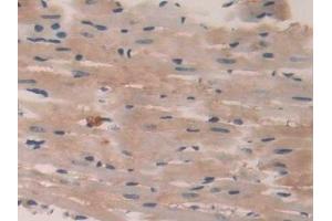Detection of PTPRB in Rat Heart Tissue using Polyclonal Antibody to Protein Tyrosine Phosphatase Receptor Type B (PTPRB)
