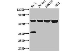 Western Blot Positive WB detected in: Raji whole cell lysate, Jurkat whole cell lysate, HEK293 whole cell lysate, U251 whole cell lysate All lanes: KPNA2 antibody at 3 μg/mL Secondary Goat polyclonal to rabbit IgG at 1/50000 dilution Predicted band size: 58 kDa Observed band size: 58 kDa (KPNA2 antibody  (AA 2-285))
