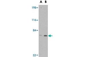 Western blot analysis of LRFN5 in EL4 cell lysate with LRFN5 polyclonal antibody  at (A) 0. (LRFN5 antibody  (C-Term))