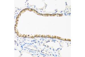 Immunohistochemistry of paraffin-embedded rat lung using CDKN2C antibody (ABIN5971074) at dilution of 1/100 (40x lens). (CDKN2C antibody)