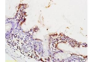 Formalin-fixed and paraffin embedded rat colon tissue labeled with Anti-PPAR alpha Polyclonal Antibody, Unconjugated (ABIN701620) at 1:200 followed by conjugation to the secondary antibody (PPARA antibody  (AA 301-400))