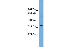 Human OVCAR-3; WB Suggested Anti-PHF13 Antibody Titration: 0. (PHF13 antibody  (Middle Region))