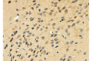 ABIN6264833 and ABIN6279044 at 1/100 staining Mouse brain tissue by IHC-P. (RPL29 antibody  (Internal Region))