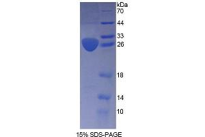 SDS-PAGE analysis of Human ARNT2 Protein.