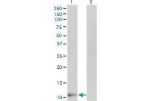 FABP6 antibody  (AA 1-128)